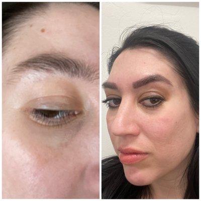 Before and after microblading/eyebrow tattooing