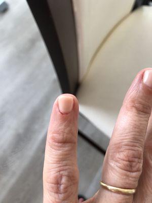 Bad cuticle cutting