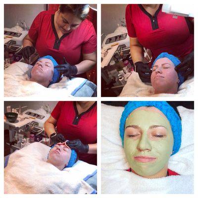 Acne treatment facial