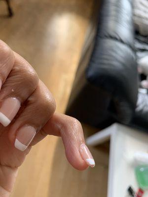 Chipping on side and bumpy white part on the left nail