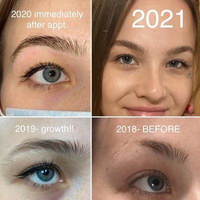 Brow progress from 2018-now