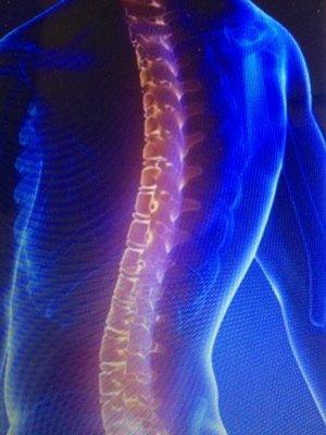 Successful treatment for neck and back pain!