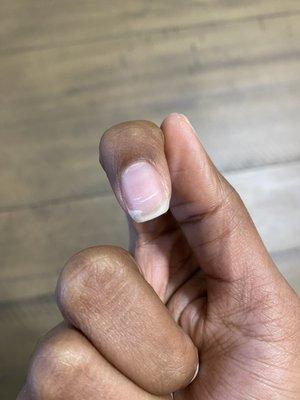 Broken nail from scraping process