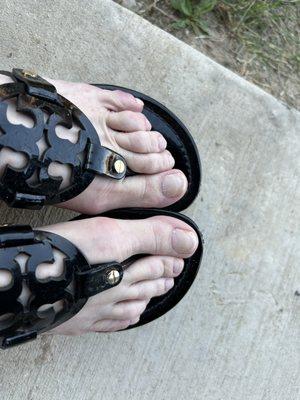 My toes after they removed their work