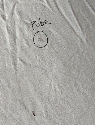 Pube.