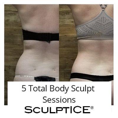 Smoothe. Sculpt. Tone. Smoothe out the areas we discussed during your free consultation.