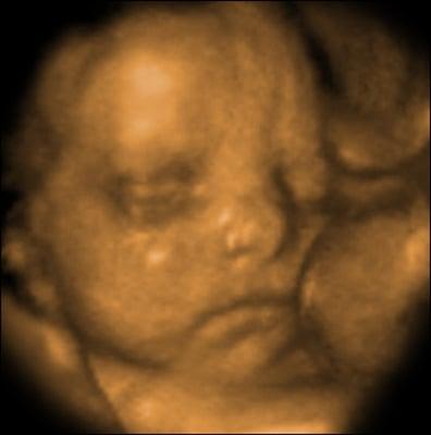 Sweet Miracles 3D & 4D Ultrasound