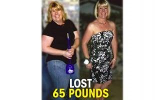 Lost 65 Pounds with Scottsdale Medical Weight Control