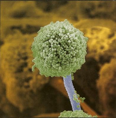 A electron microscope view of a mold conidiophore.  The little balls on the puff ball are mold spores, the "seeds" of mold.