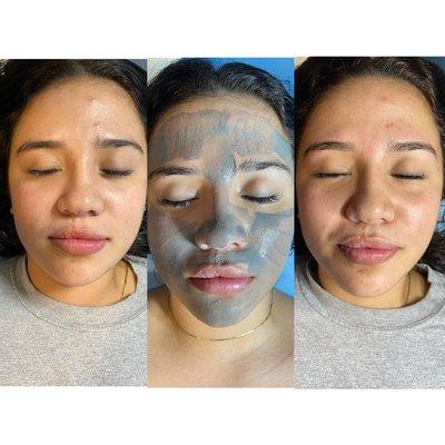 Before during and after facial with eye brow wax