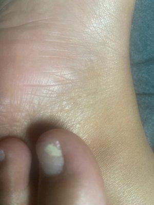 Got mail fungus from this nail salon it's just f horrible