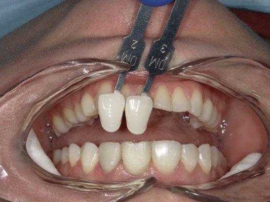 Evenly Orthodontics-Advanced Dental Designs of Sellersville