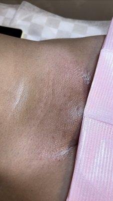 Sugaring Brazilian