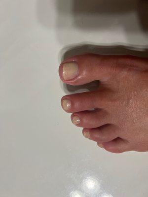 Toenail polish