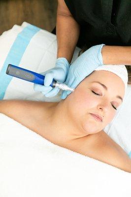 We love microneedling and micropenning to brighten the skin and address texture.