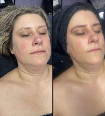 Before and After of our amazing anti aging facial! this client also added a eyebrow wax and tint to her service!