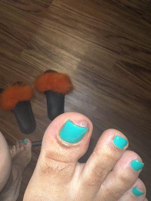 After the pedi , this happened the next day