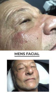 Men's Facial