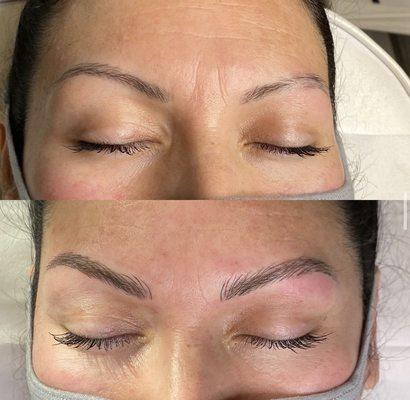 Before and after microblading