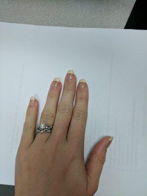 Yellow nails after 1.5 weeks. Gross.