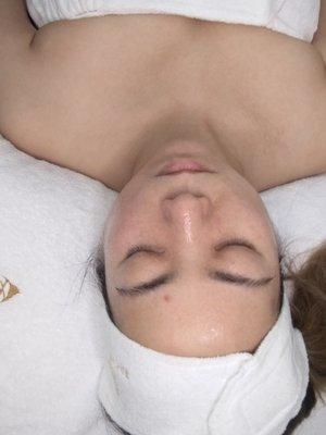 Microdermabrasion Facial with Hydrating Hyaluronic Mask