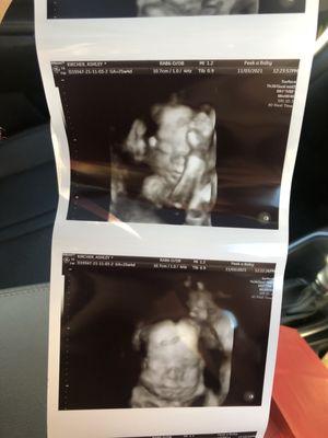 The Peek a Baby 3D  4D Ultrasound Boutique