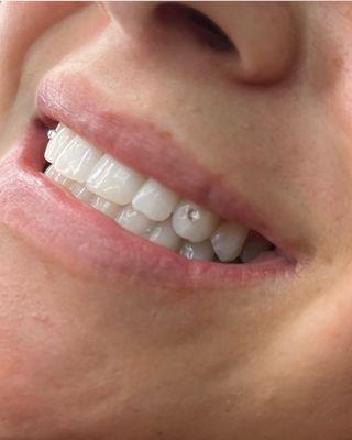 Teeth gems  add bling to your smile book appointment 831-234-5198