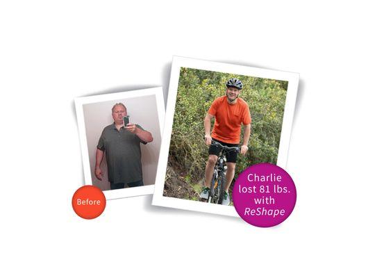 Charlie lost 81 pounds with the ReShape Balloon