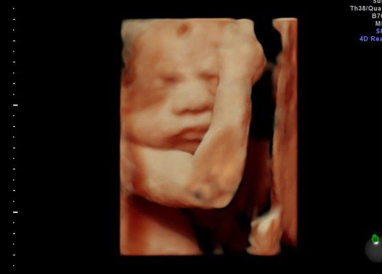 Baby covering face 3d Imaging