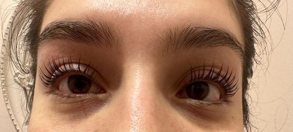 Right after procedure (curling and tinting eyelashes)