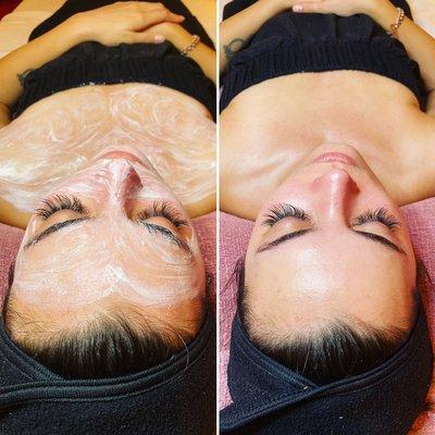 Enzyme facials always leave your skin glowing!