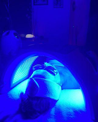 Blue light therapy kills acne causing bacteria and reduces inflammation.