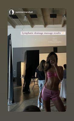 instagram.com/silhouettebysophia Lymphatic drainage results