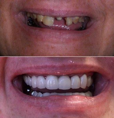 Amazing transformation done by Dr. Tony!