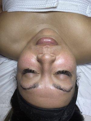 Hydra facial!