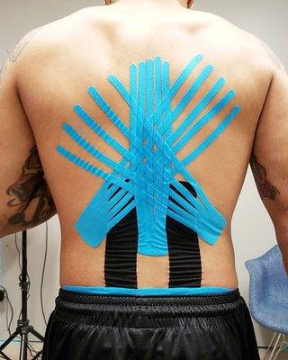 Kinesio Taping Service