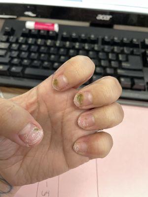 Fungus or "water damage" nails?