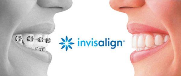 Free Invisalign Consultations!