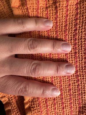 Nails removed by salon