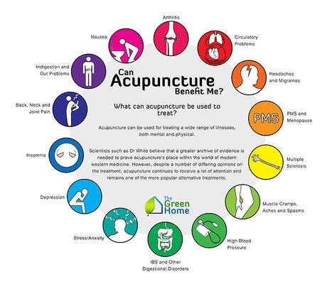 Benefits of Acupuncture!