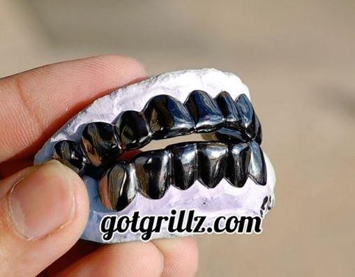 Black Gold Grillz Custom Made