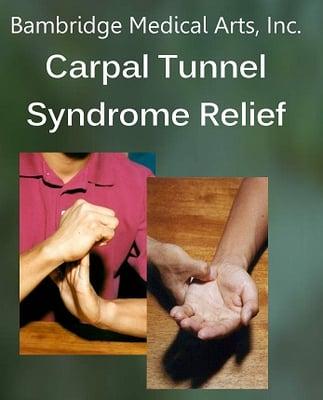 You can learn how to treat your carpal tunnel syndrome at home. We will teach you.