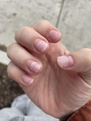 Nail damage