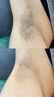 Underarm Wax