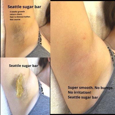 Underarm sugaring is far more gentle than waxing. We sugar towards the natural growth. We never sugar the direction of waxing.