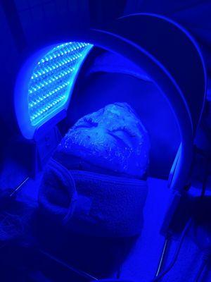 UV light facial!