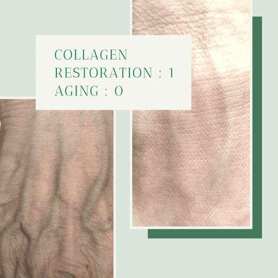 Collagen restoration in hands