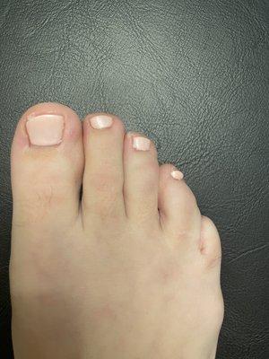 Left nail polish all over big toe