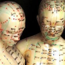 Acupuncture