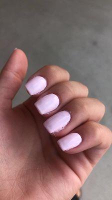 Horrible nail job from venetian nails